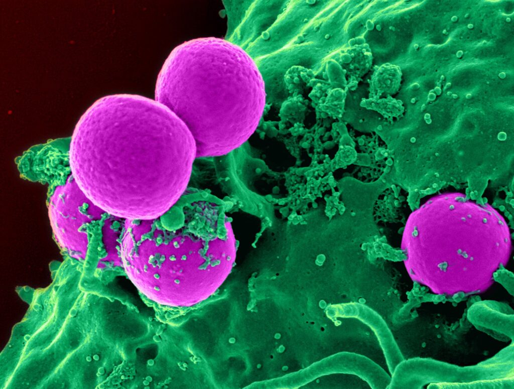 Scanning electron micrograph of a human neutrophil ingesting MRSA