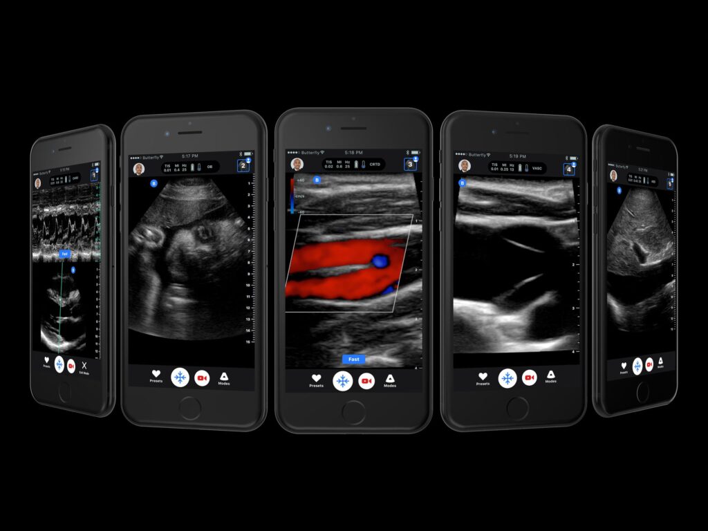 Butterfly IQ+ Clinical Screens